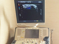 超音波画像観察装置を使用した検査